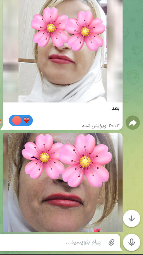 کرم روزاکسپرت فابرلیک روسیه باSPF 50ضدلک وروشن کننده پوست
